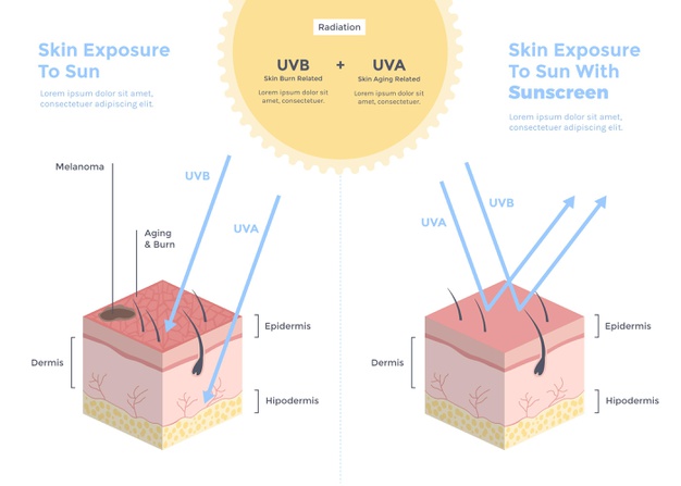 skin barrier